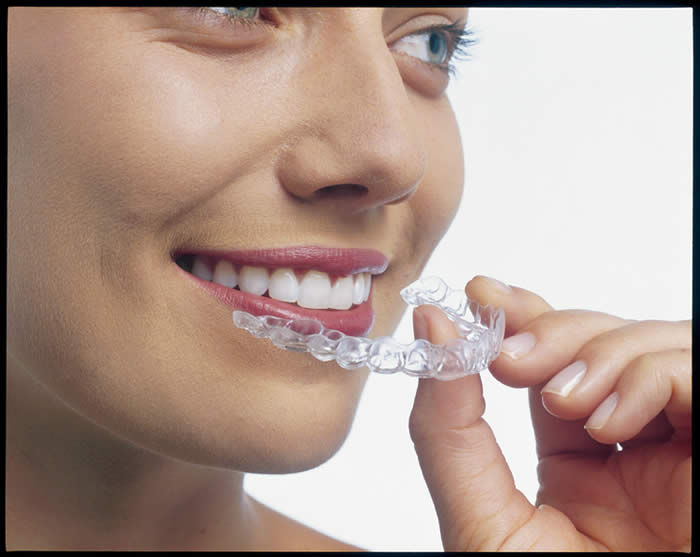 invisalign dentist